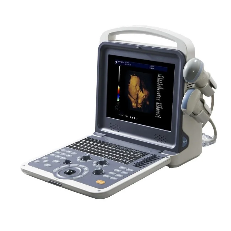 
			Escáner de ultrasonido Doppler color portátil AR-480C		