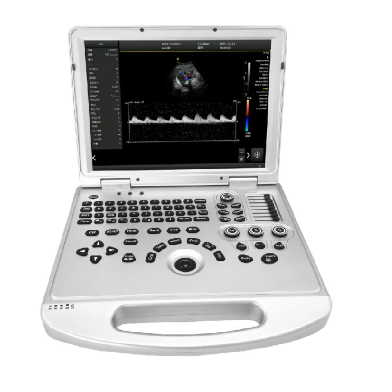 
			Escáner de ultrasonido Doppler color AR-K3		