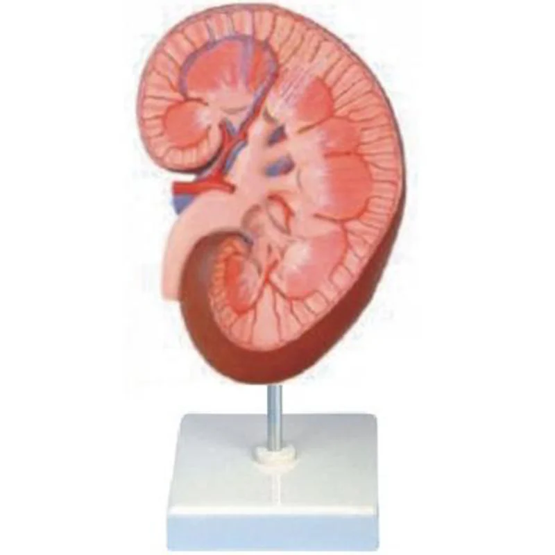 14005 Kidney Model