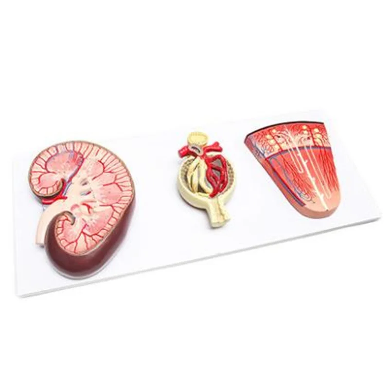 14007 Kidney Section with Nephron and Renal Corpuscle Model