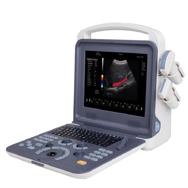 AR-480D Portable Color Doppler Ultrasound Scanner