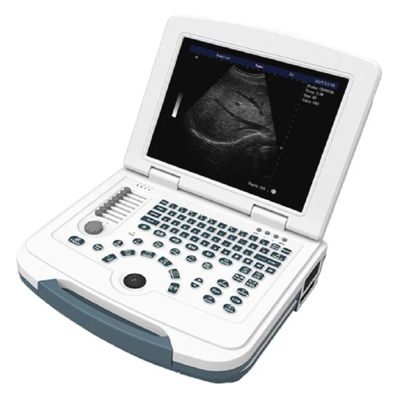 AR-9000C B/W Laptop Full Digital Ultrasound Scanner
