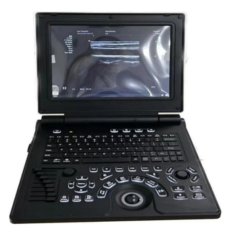 AR-K20 3D Portable Color Doppler Ultrasound Scanner